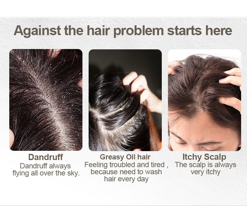 Organic Shampoo Soap - Vegan Handmade Cold Processed Refreshing Anti-Dandruff Hair Shampoo